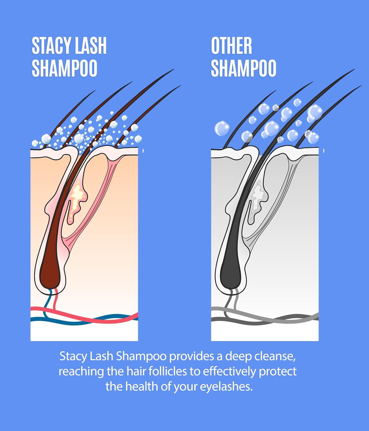 STACY LASH Lash Shampoo 50ml+ Eyelash Growth Serum Cleaning Kit of Eye Makeup Remover (Cleanser) + Brush & Eyelash Serum for Eyelash Growth and Thickness