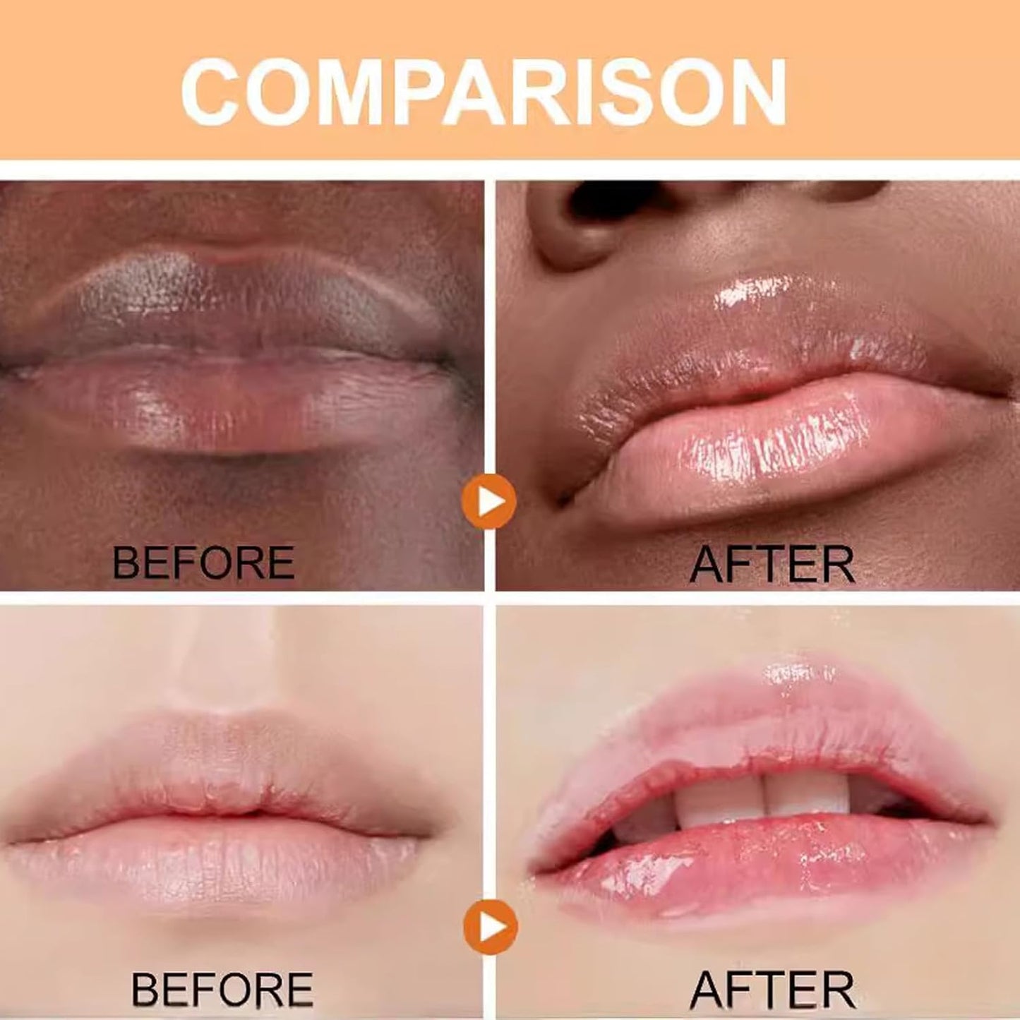 Turmeric Lip Balm for Smokers With Root Oil - Brightening for Dark Lips, Long-Lasting Moisturizer for Dry, Cracked, and Dull Lips - All Natural Hydrating Skin Care, 0.17 oz