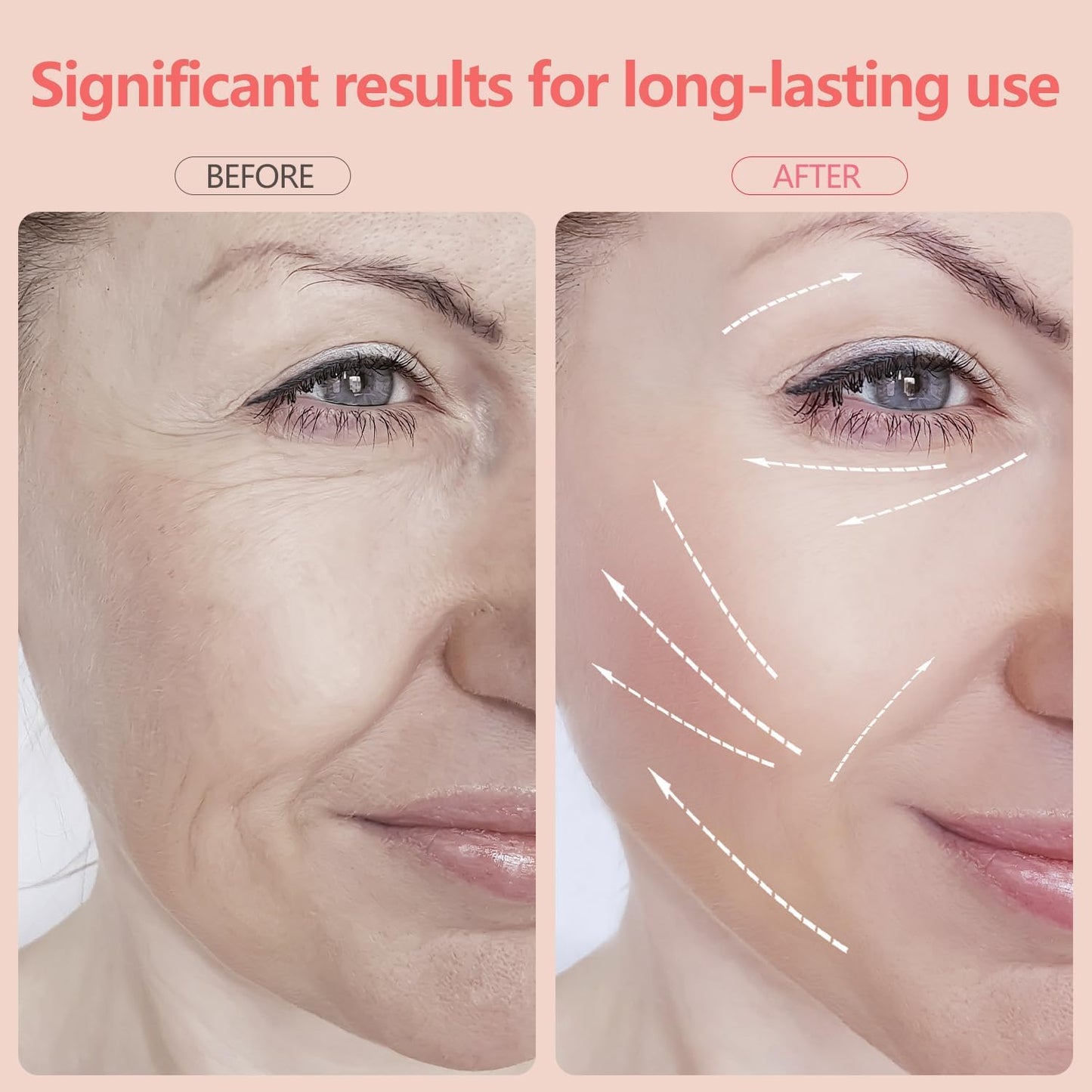 2025 New Face and Neck Massager Tool, 7 Colors LED Womens Skin Care Facial Massager for Skin Rejuvenation, Lifting, Toning, Glow Boost-White