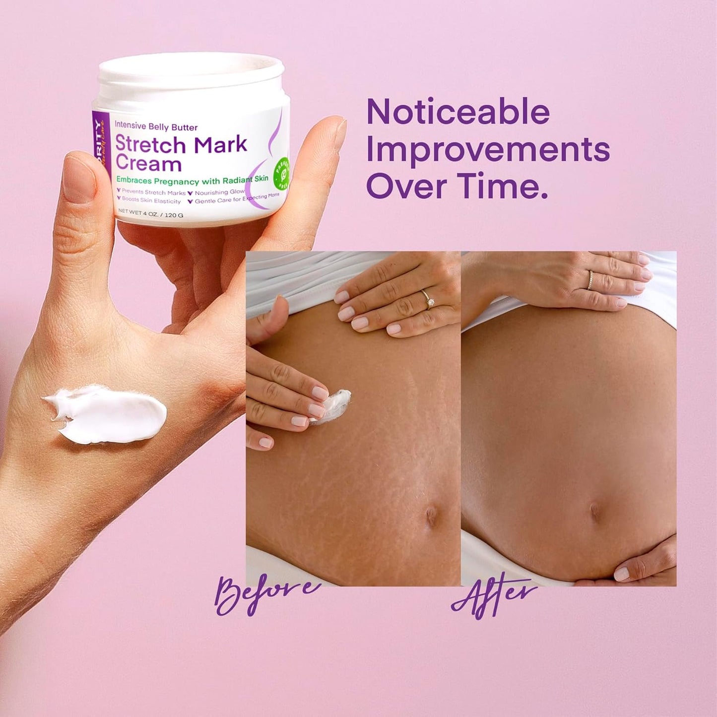 Stretch Mark Cream for Pregnancy: Stretch Mark Treatment - Belly Butter For Pregnant Women - Massage Lotion To Prevent And Repair Maternity Stretch Marks Scar - 4 Oz