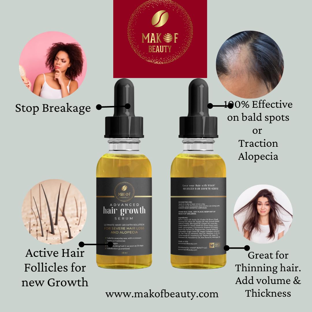 Effective Hair Growth Treatment: Biotin, Collagen, Protein and 38 Essential Oils for Longer, Thicker Hair. Moisturizes Scalp, Prevents Dandruff and Edges Loss. 60ML