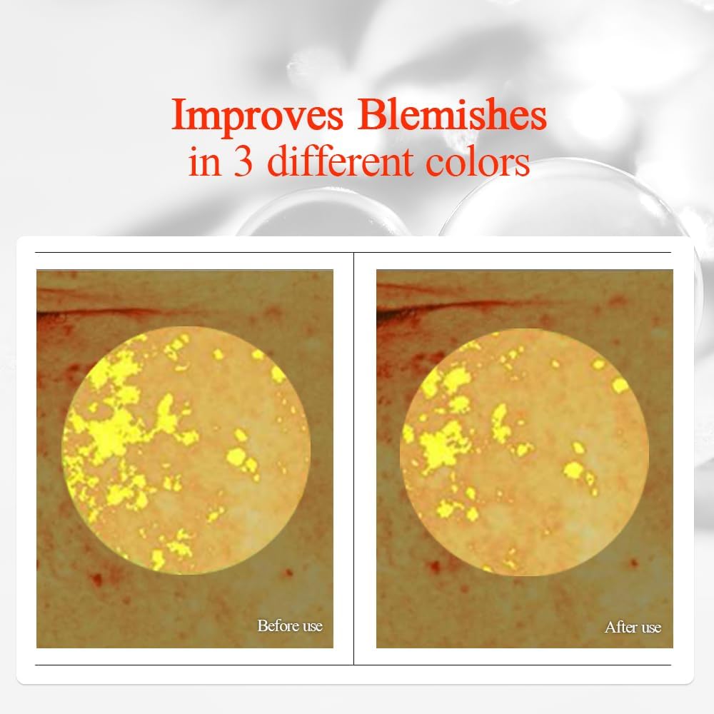 [PKY] Pyunkang Yul Brightening Vita Toner for Flawless and Radiant Skin, Blemish Care Toner with Vitamin C & Niacinamide, Zero Irritation, Korean Skincare (5.07 Fl. Oz, 150ml)