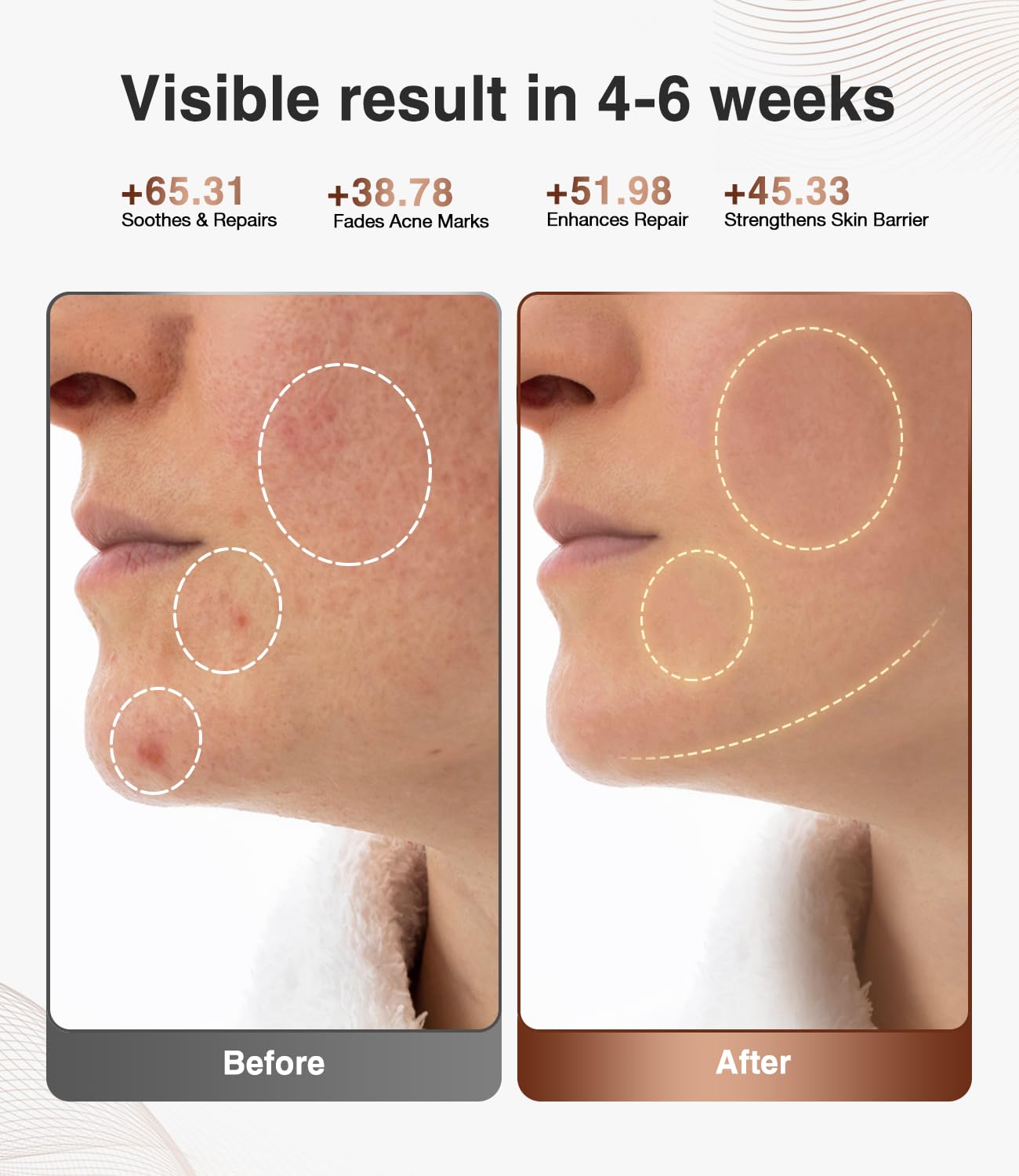 JOVS LED Light Therapy Face Mask, Wireless Red Light Therapy for Face, Portable Skin Care Beauty Device Intelligent Beauty Solution at Home