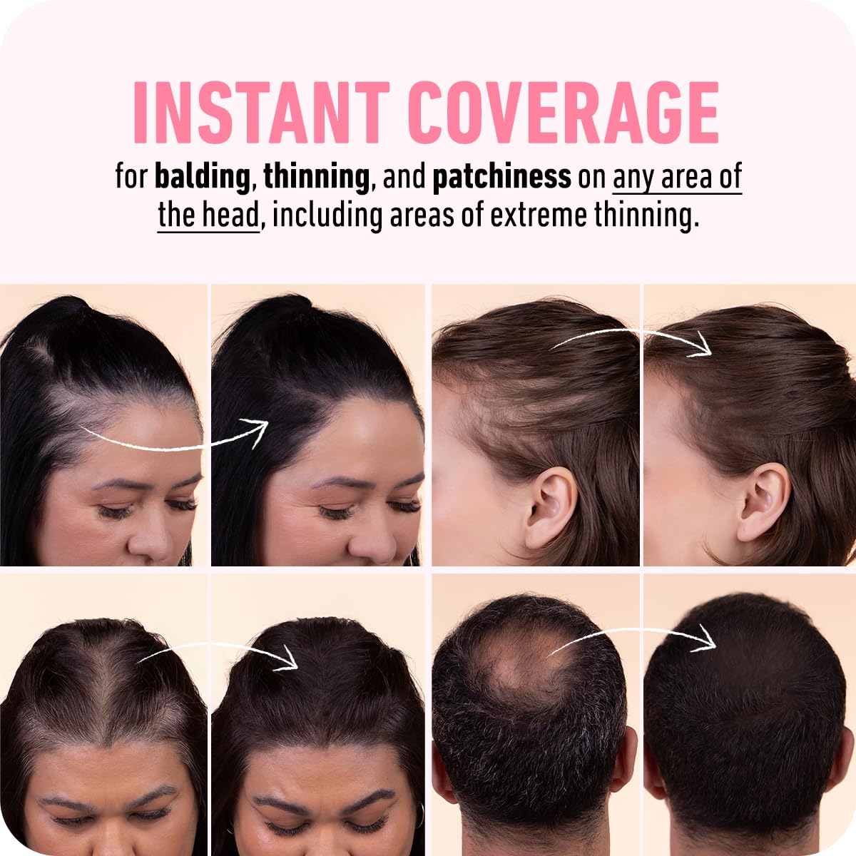 BOLDIFY Hairline Powder - Root Touch Up Hair Color for Gray Coverage - Bald Spot Concealing Hair Powder for Women & Men - 48-Hour Stain-Proof - Auburn