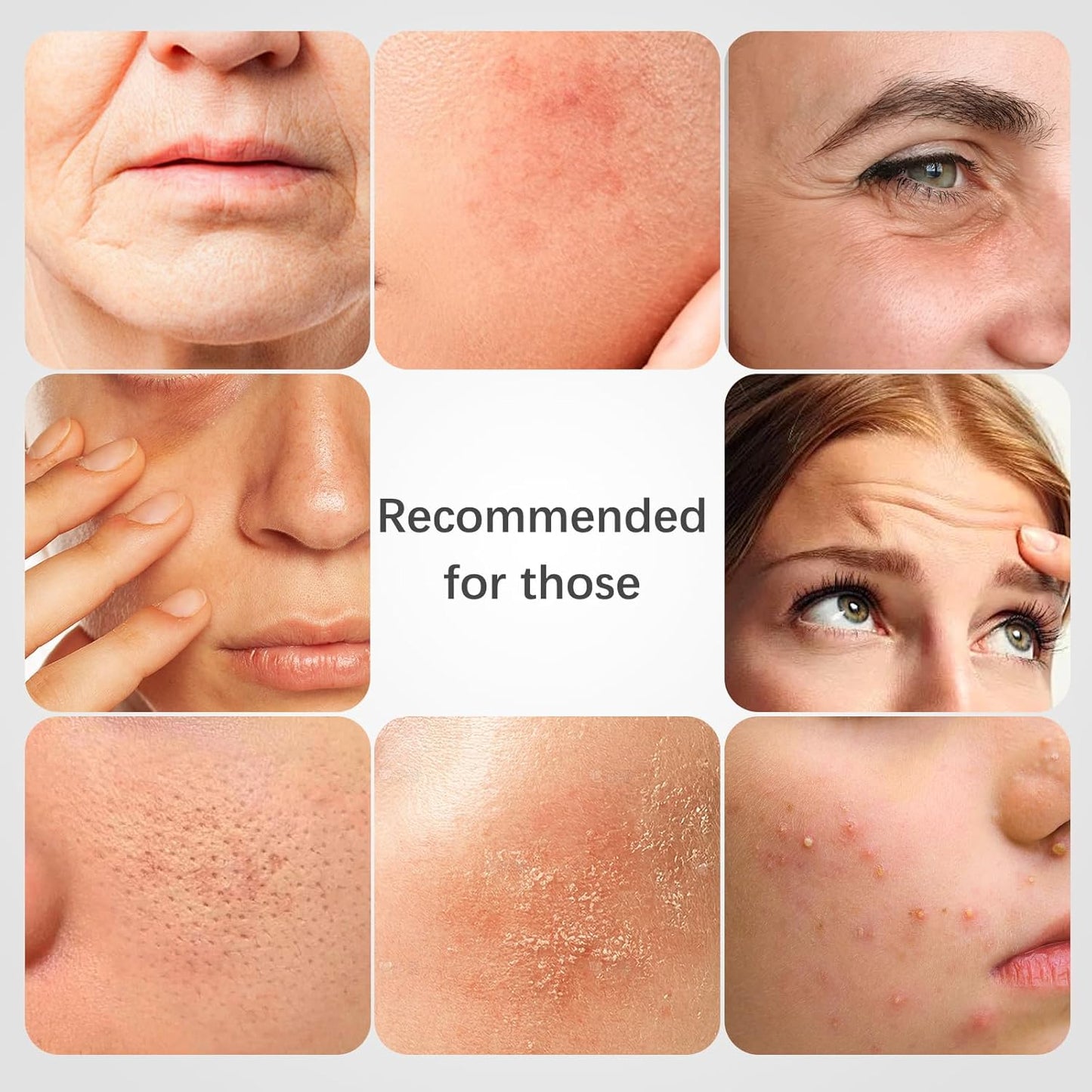 ISTON 4-in-1 Bio-Collagen Real Deep Mask Set -Plump Sagging Skin,Deep Hydration,Soothe & Repair,Nourish & Firm, Overnight Hydrogel Mask for All Skin Type