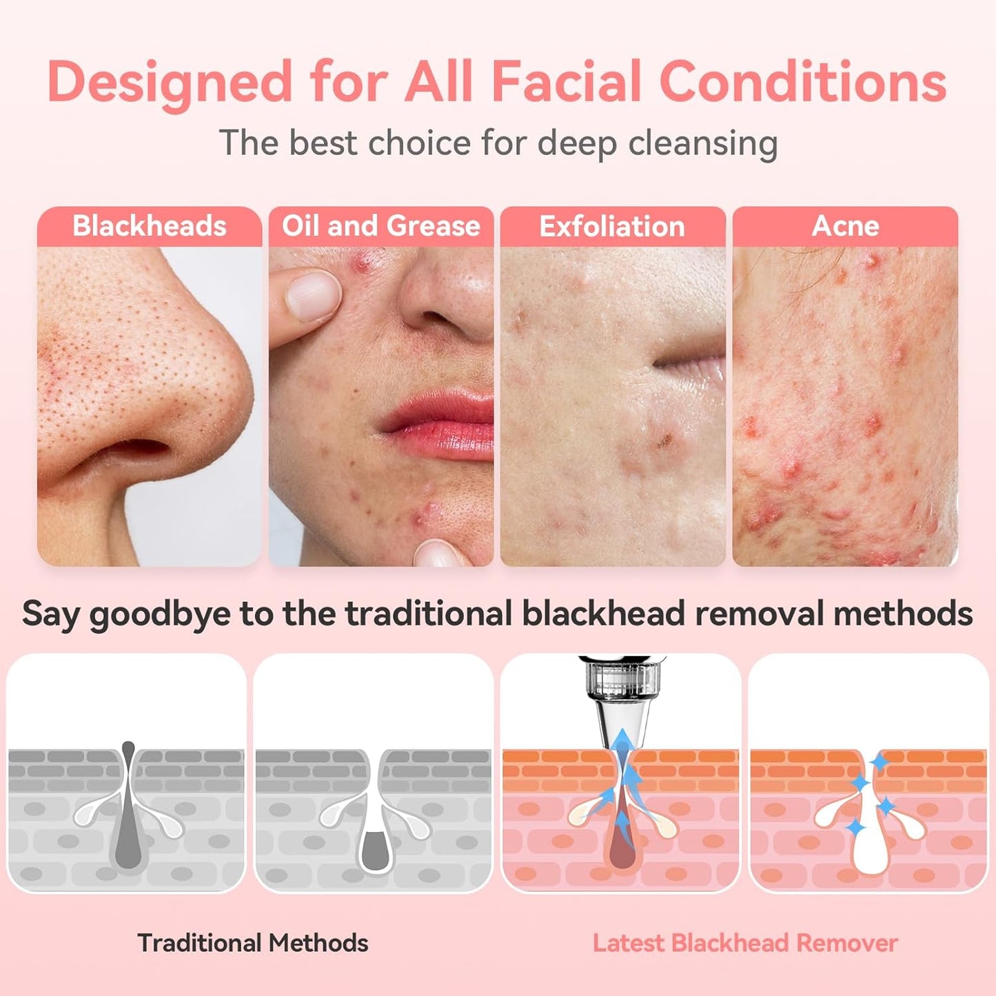 Blackhead Remover Pore Vacuum Upgraded Facial Pore Cleaner Electric Comedone Whitehead Extractor Tool-5 Suction Power,5 Probes,USB Rechargeable Blackhead Vacuum Kit for Women & Men