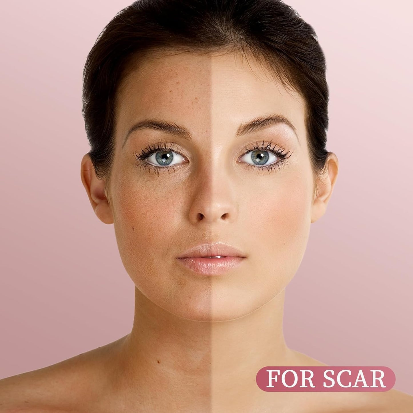 Yoken Rosehip Seed Oil For Face,100% Pure Rosehip oils For Skin,Scars,Hair & Nails.4 fl Oz Cold Pressed Rose Hips Oil For Skin Care, Anti-Aging, Scar Treatment, GUA SHA Massage DIY (4 Fl Oz)