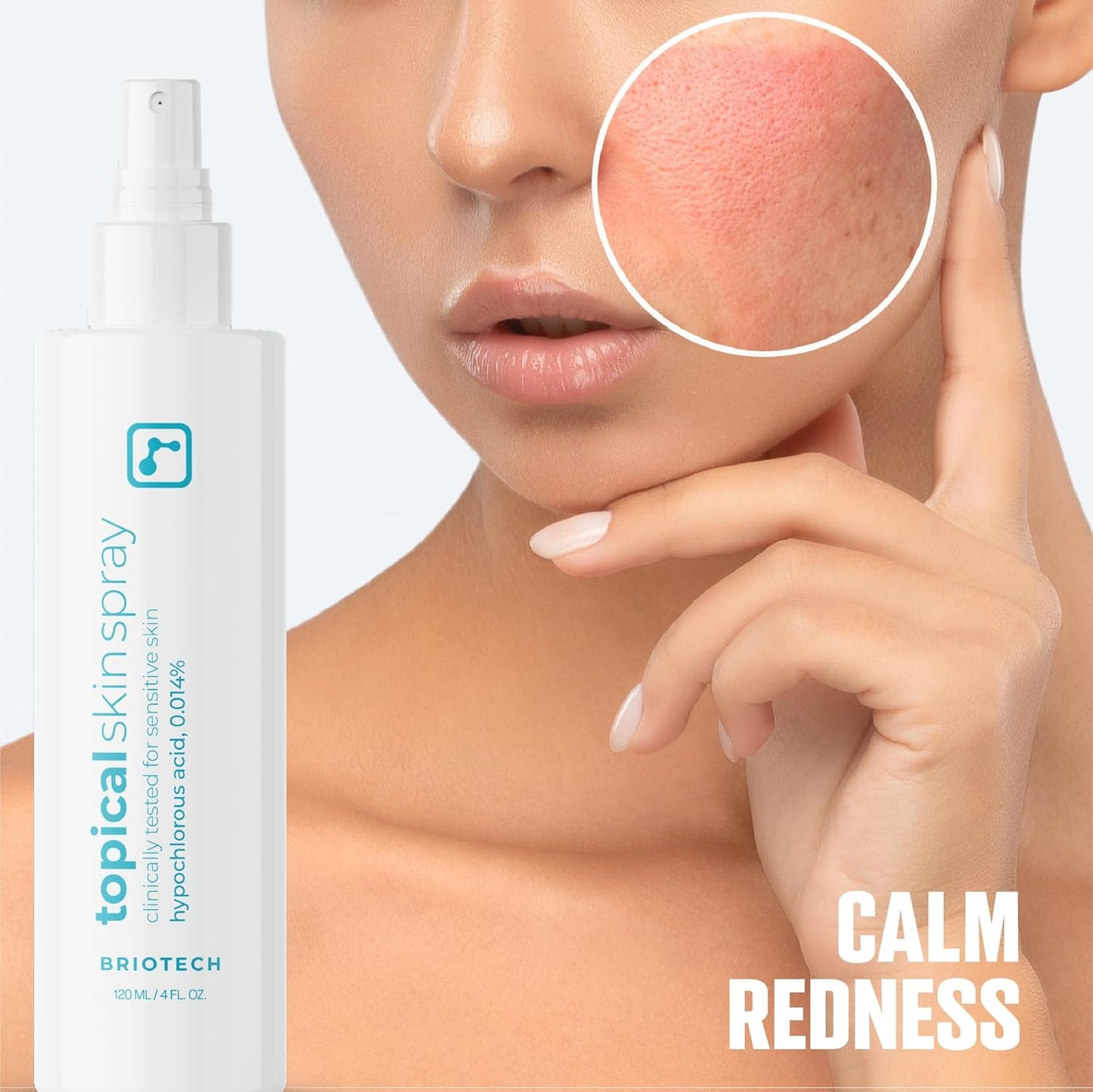 BRIOTECH Topical Skin Spray, Hypochlorous Acid Spray for Sensitive Skin, HOCl Facial Mist, Full Body Support Against Irritation, Calm Redness, Soothe Foot & Scalp, 8 oz (1 Pack)