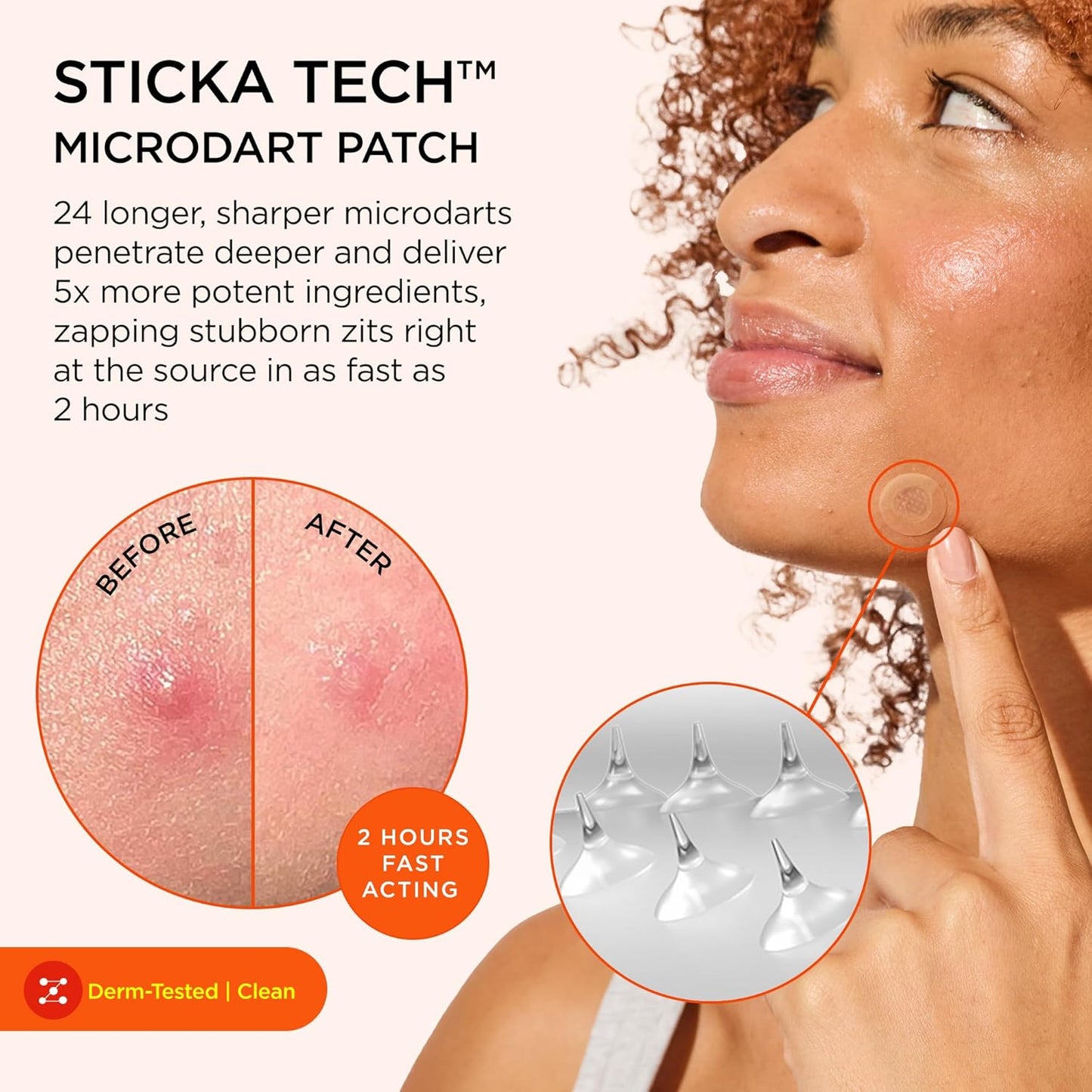 ZitSticka Extra Strength Killa Acne Patches for Face - World's Most Potent Pimple Patch with Fast-Acting Microdarts - Starts Working within 2 Hours for Deep, Early-Stage Zits & Blemish - 20 Count