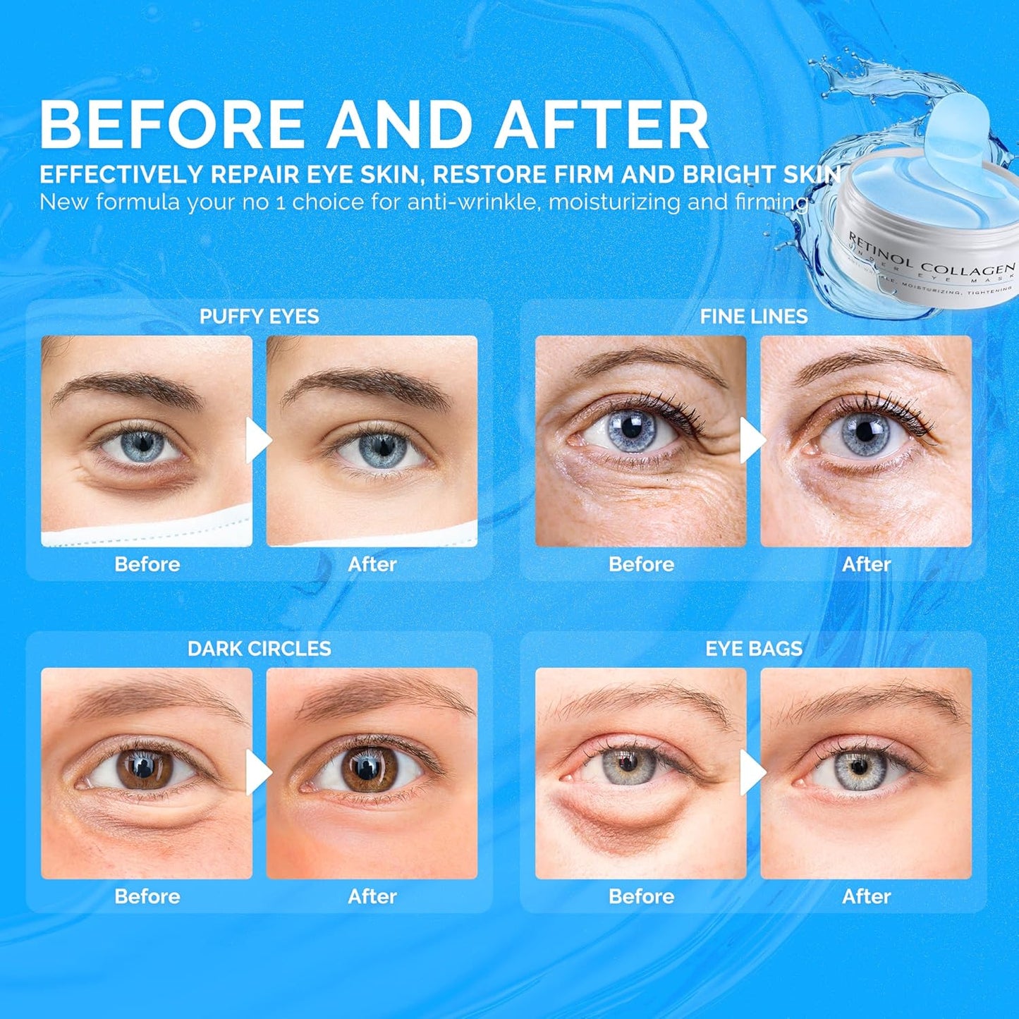 Under Eye Patches for Dark Circles: 30 Pairs Enaskin Naturals Retinol Collagen Eye Gels Mask - Reduce Wrinkles Puffy & Bags - Skin Treatment Pads - Anti Aging Moisturizer For Women (Blue)